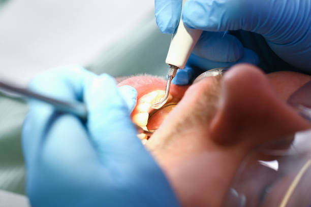 Emergency Dentist Open Today in OH