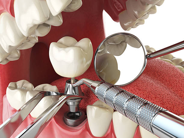 Best Emergency Gum Pain Relief  in Lorain, OH